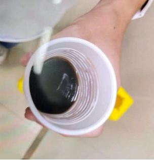 15岁女生军训后排“酱油尿”，竟是肌肉“溶解”了？