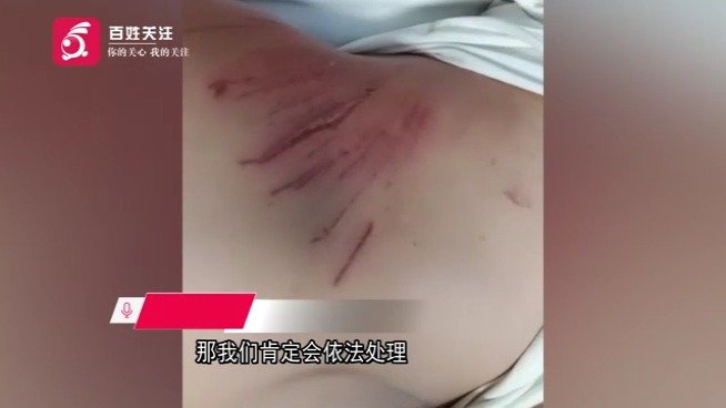 警方通报渭南一村支书打人 ：因餐费问题起争执 村支书父子打人被行政拘留