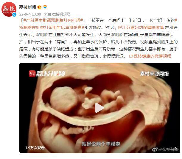 产科医生回应“双胞胎肚内打架”：“都不在一个房间！”