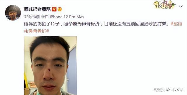 曝赵继伟伤情被诊断为鼻骨骨折 目前没有提前回国治疗的打算