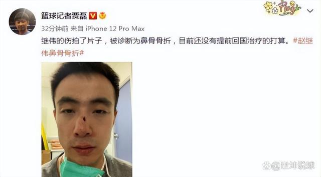赵继伟确诊鼻骨骨折，不打算提前回国！小高搞怪，将缺席1-2个月
