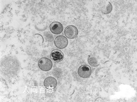 美国50个州均已发现猴痘病例 累计病例超1.54万例 美国现近20年来首例猴痘病例