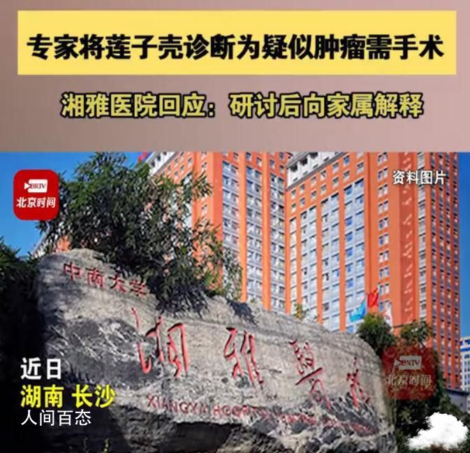 湘雅回应专家将莲子壳诊断为肿瘤 目前已接到相关反映会进行讨论研究