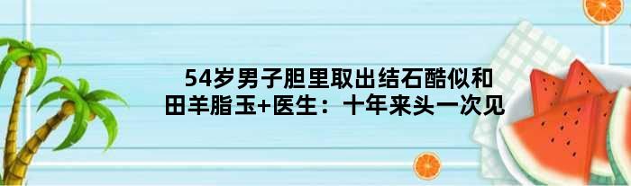 54岁男子胆里取出结石酷似和田羊脂玉 医生：十年来头一次见