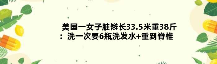 美国一女子脏辫长33.5米重38斤：洗一次要6瓶洗发水 重到脊椎弯曲